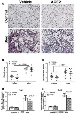 rhACE2 Therapy Modifies Bleomycin-Induced Pulmonary Hypertension via Rescue of Vascular Remodeling